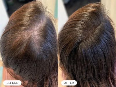Inero Scalp & Hair Renewal Spray